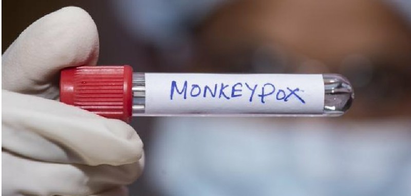 الصحة العالمية :18 الف إصابة بجد ي القرود في 78 دولة