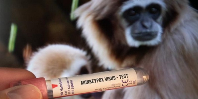 حقيقة تأجيل الدراسة بعد ظهور أول إصابة بجدري القرود بمصر