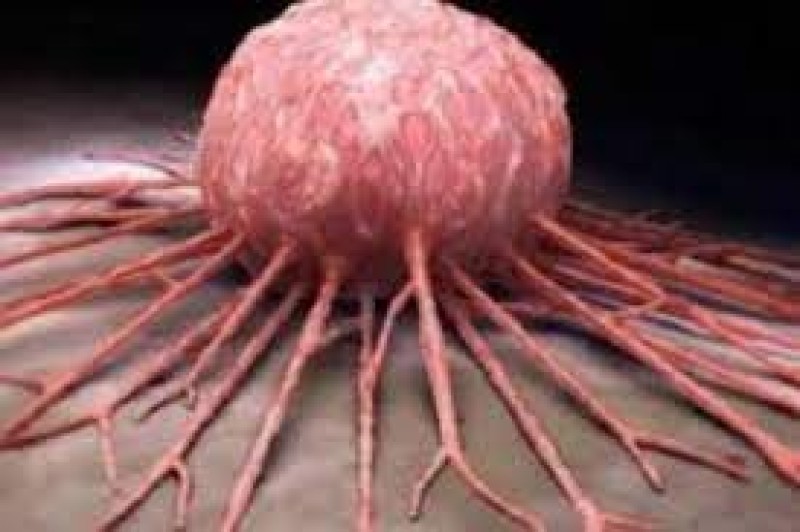 العلماء يتوصلون لطريقة تقلل من خطر الإصابة بالسرطان بنسبة 61%