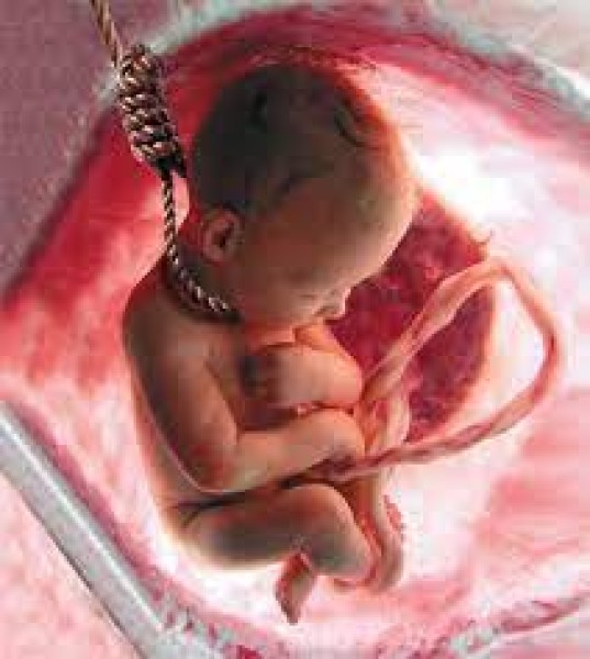 اجهاض الجنين