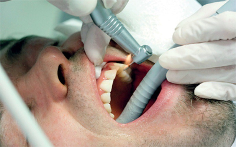 دعوات لوقف إستخدام الـ «أملغم» الزئبقية في علاج الأسنان الأطفال