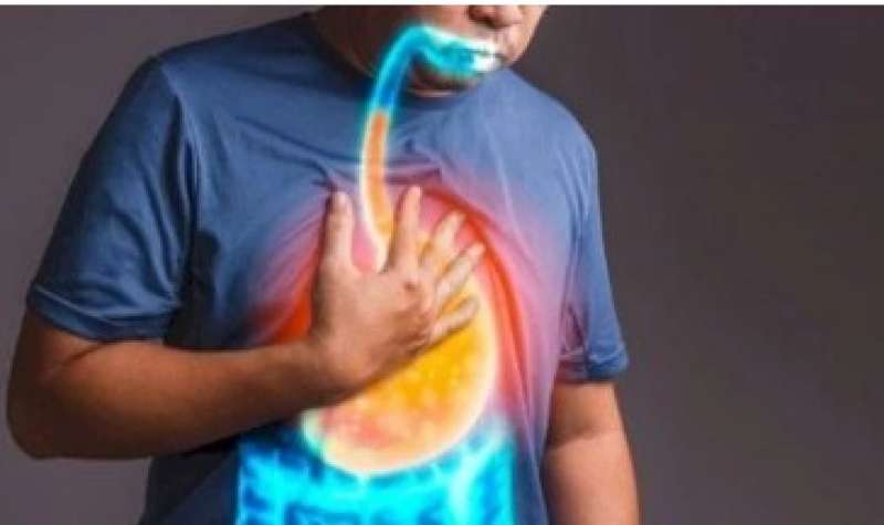 أثناء النزيف وبعده .. طرق علاج دوالي المريء