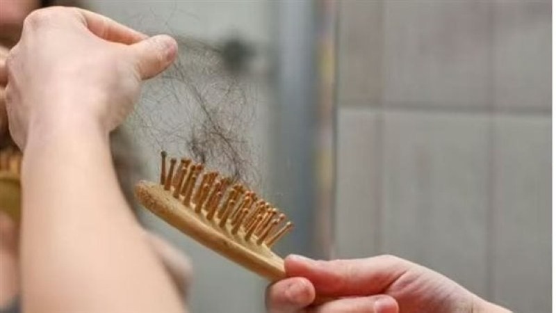 علامات خطيرة لـ تساقط الشعر