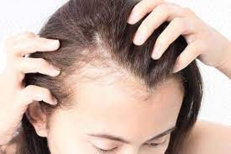 هل يمكن لهذا العلاج القديم أن يعالج تساقط الشعر؟