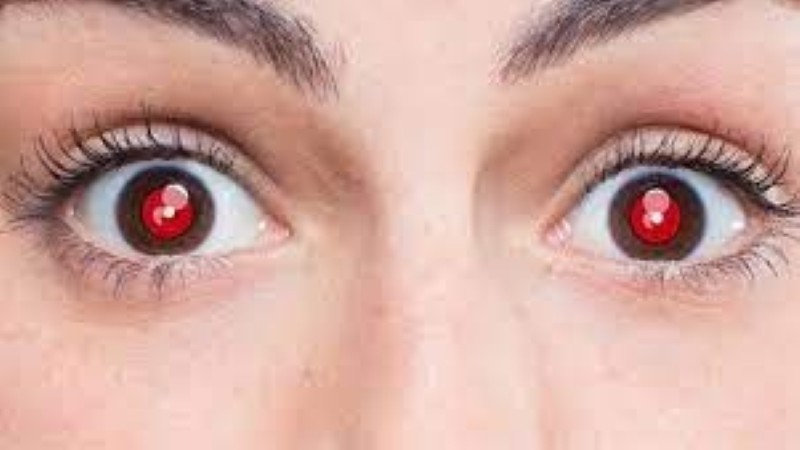 ظهور العين الحمراء في الصور يشير لهذا المرض