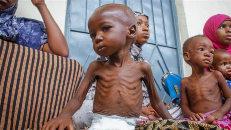 الأمم المتحدة: 220 ألف طفل في السودان سيموتون بسبب سوء التغذية