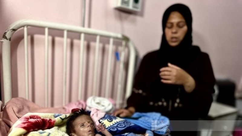 وفاة رضيع نتيجة سوء التغذية والمجاعة في قطاع غزة