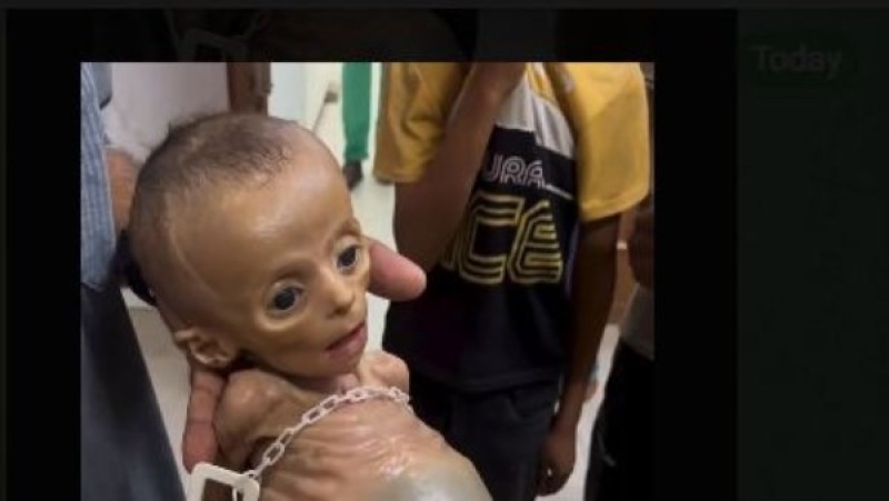 الإعلام الحكومي: مقتلة جماعية مرتقبة بحق 100,000 طفل