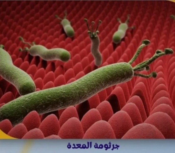 جرثومــة المعــدة والغــذاء المنـاسب