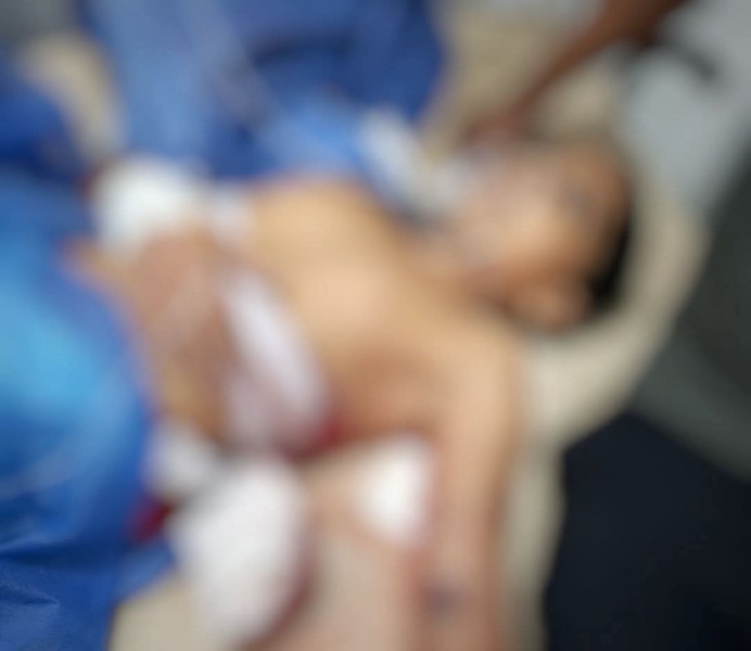 مشاجرة بنطاق حي الزهور ببورسعيد وإصابة شخص بخرطوش وطفل تصادف وجوده بالشارع