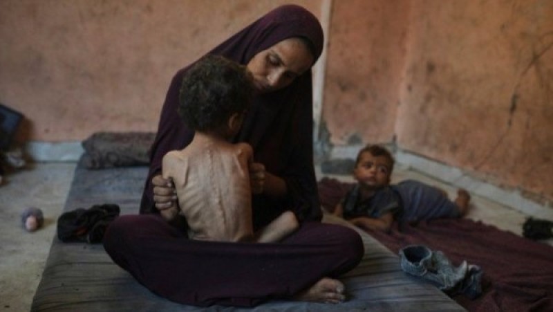 لسوء التغذية.. مصدر طبي في مستشفى الشفاء بغزة يعلن استشهاد الرضيعة رانيا غبن
