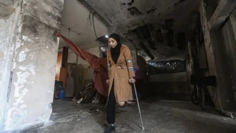 الإغاثة الطبية في غزة: 5 آلاف فلسطيني فقدوا أطرافهم ويحتاجون لعمليات عاجلة