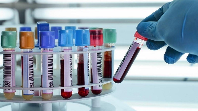 فحوصات وتحاليل طبية دورية ضرورية للمرأة كل عام