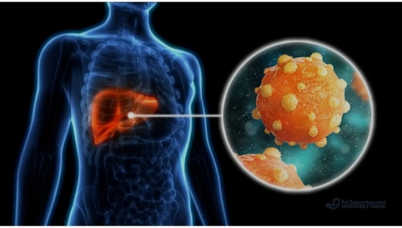 خطورة فيروس بي .. وحجم الخطر علي المخالطين للمريض به