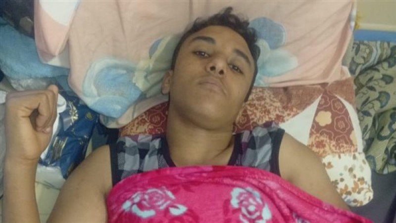 دمنهور تشهد واقعة مؤسفة: شاب يتعرض لحروق بالغة بعد أن سكب زملاؤه تنر عليه