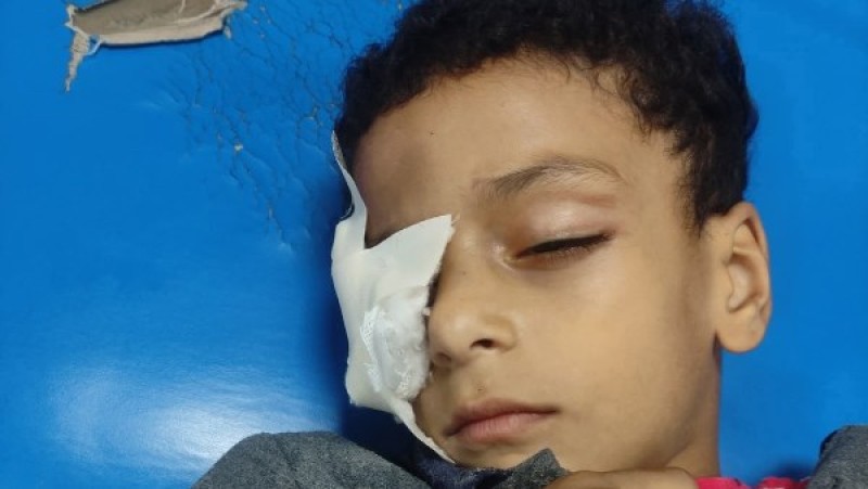 استدعاء مُعلمة الألومنيوم للتحقيق معها فى واقعة تصفية عين تلميذ بنجع حمادى