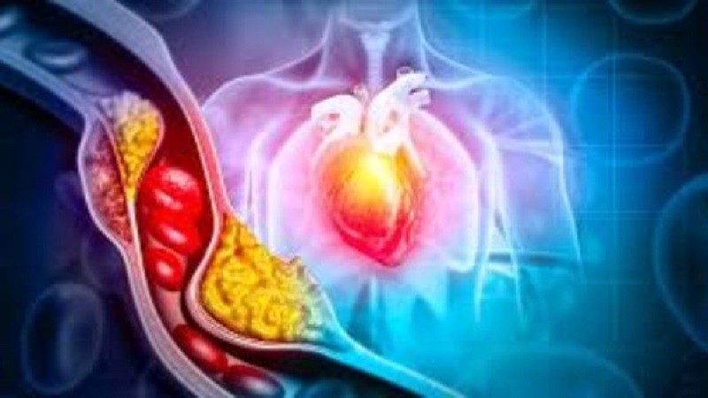 مشروبات تعالج ارتفاع نسبة الكوليسترول في الدم