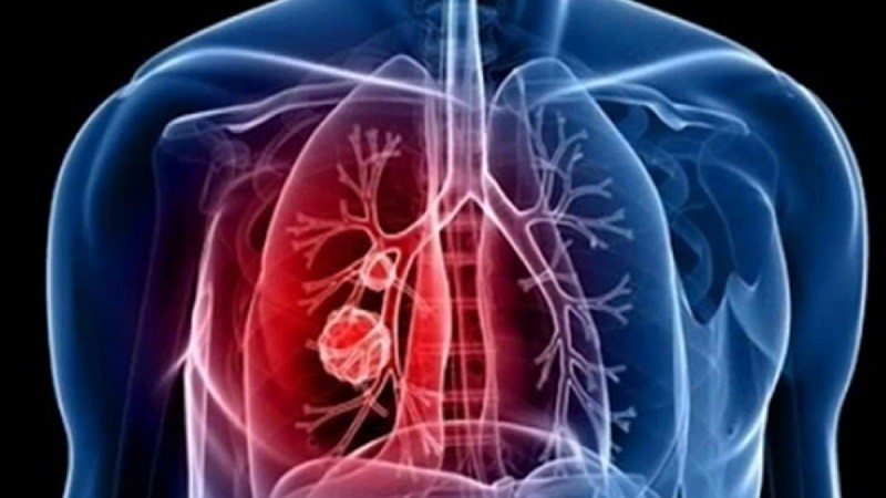 أهم المشروبات لدعم صحة الرئة.. حل سحري