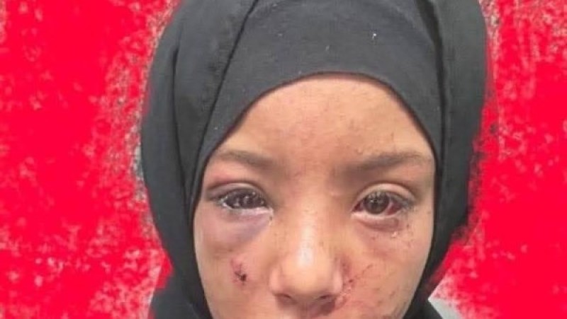 حاول خلع عينيها لعدم التعرف عليه.. محاولة هتك عرض طفلة تهز الشرقية