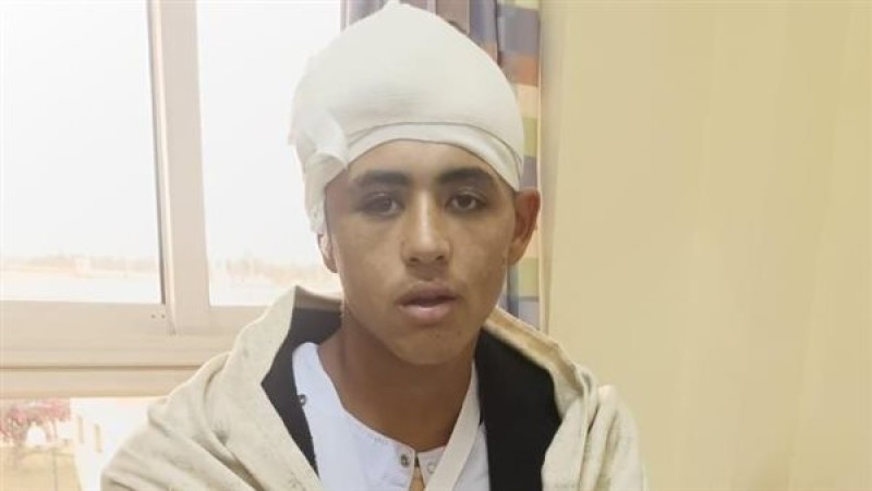 معجزة طبية في البحيرة: طالب ثانوي ينجو من كسر بالجمجمة ونزيف حاد بالمخ