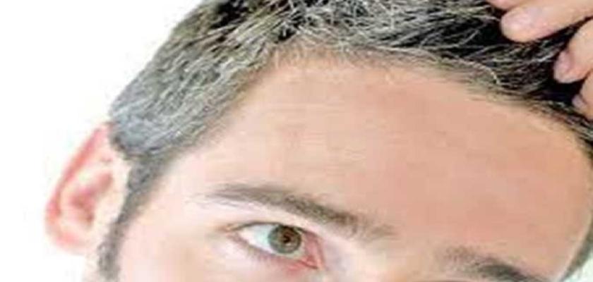 أطعمة تعالج الشعر الأبيض وتعيد الشباب