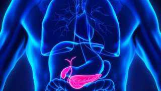 طفرة علمية جديدة.. علاج ثلاثي يقضي على سرطان البنكرياس