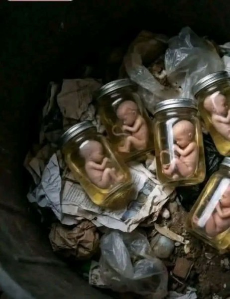 ذهول من العثور علي ١٠ أجنة في صندوق قمامة داخل برطمانات بالمنيا