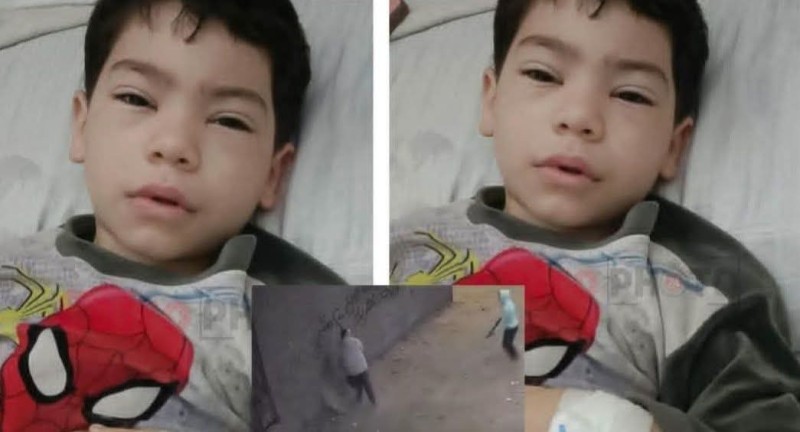 مصادر: الحالة الطبية لطفل باسوس: لم يتعرض لبتر في قدمه