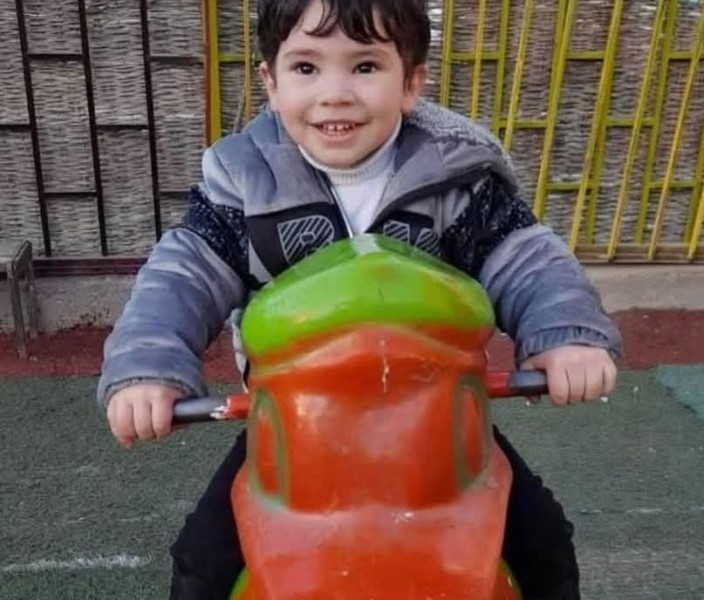 طفل باسوس اجرى جراحة بمعهد ناصر لمدة ١٣ ساعة