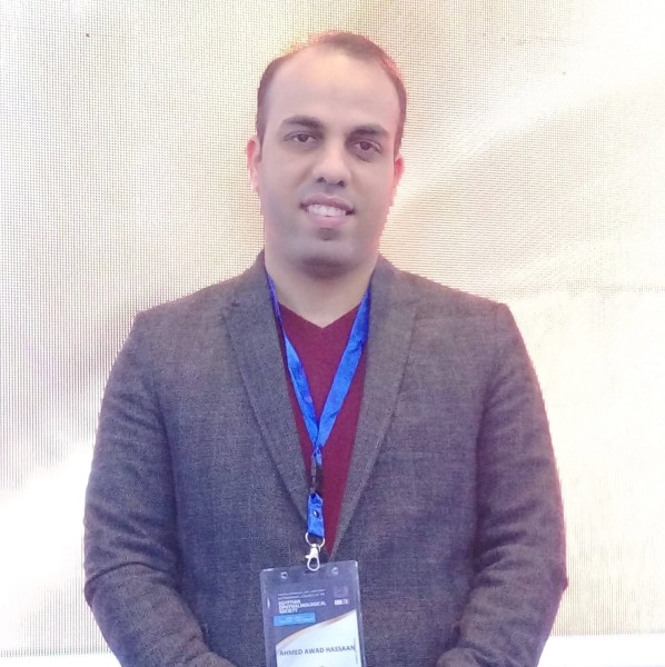 الدكتور احمد عوض حسان جعل من مستشفى رمد المنصورة قلعة طب وبسرعة الصاروخ في عالم التشخيص والعلاج