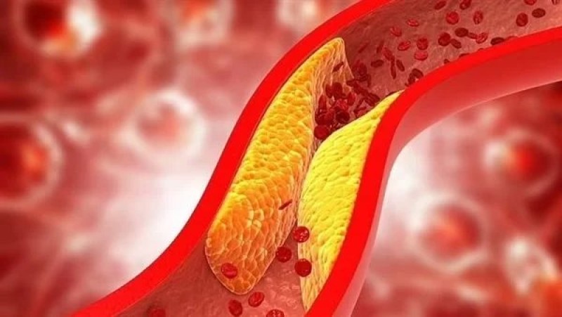 لتحسين صحة القلب.. تناول هذه الفاكهة يوميا يخفض الكوليسترول