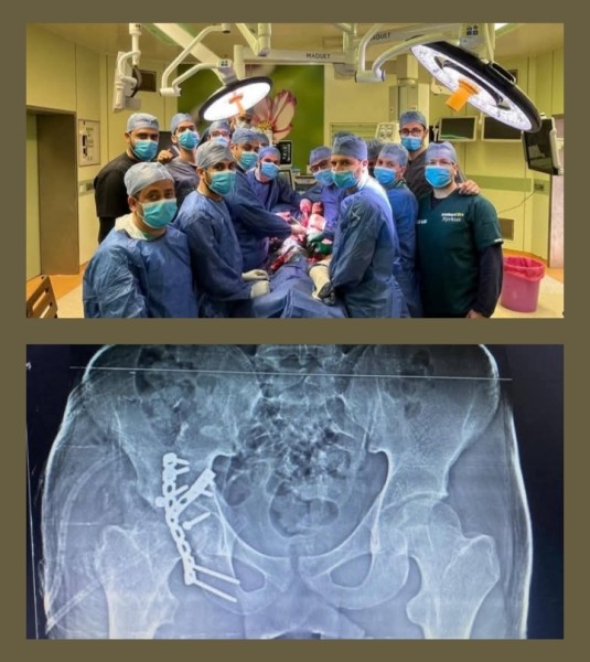 فريق جراحة العظام بمستشفى كفر الشيخ الجامعي ينجح في إجراء عملية نادرة ومعقدة