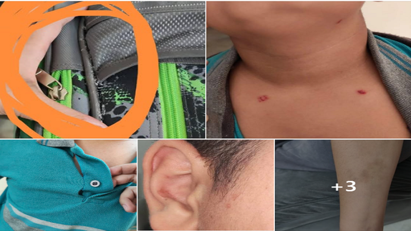 قرار عاجل بنقل طالب أبو النمرس ”ضحية الضرب والتنمر” لمدرسة أخرى