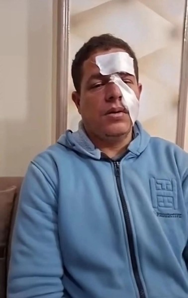 تفاصيل اكثر حول قضية وأزمة تعدي طالب علي معلم بسلاح أبيض واحداث إصابته بمدرسة بأجا في الدقهلية