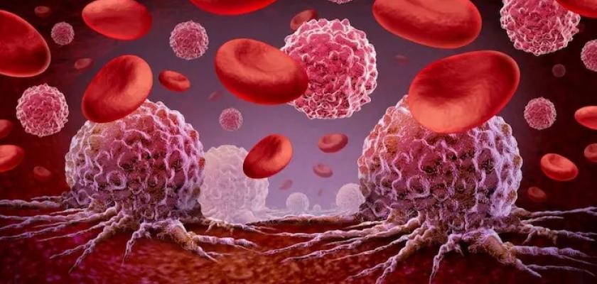 أعراض السرطان في الجسم .. 10 علامات تنذرك بالمرض الخبيث