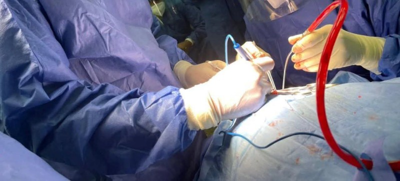 إنقاذ طفلة من ”زائدة منفجرة” بمستشفى ساقلتة بسرعة احترافية ..  بعد تشخيص خاطئ بمستشفى خاصة