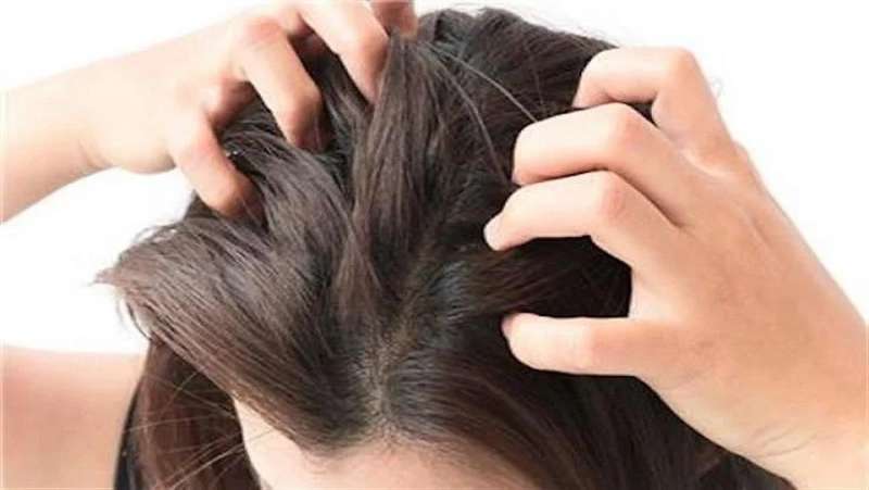 رائحة الشعر تتغير سريعًا بعد الغسل.. 6 أسباب تتعلق بفروة الرأس