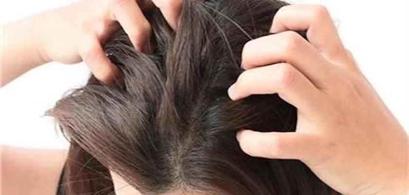 رائحة الشعر تتغير سريعًا بعد الغسل.. 6 أسباب تتعلق بفروة الرأس